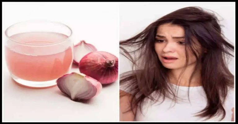 Benefits of Onion Juice