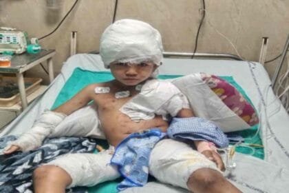 रायपुर में आवारा कुत्तों का हमला, 6 साल के बच्चे की हालत गंभीर