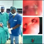 13 साल के बच्चे के फेफड़े से निकली पिन, एम्स रायपुर के डॉक्टरों ने किया कमाल