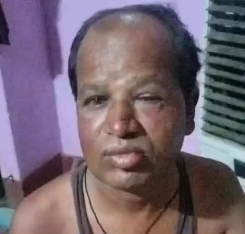 बलौदाबाजार: पेट्रोल पंप सुपरवाइजर पर हमला, 3 युवक गिरफ्तार