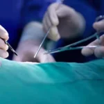 https://news4u36.in/wrong-leg-surgery-bilaspur-high-court-action/