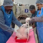 https://news4u36.in/giant-uterus-fibroid-found-during-postmortem-ambikapur-chhattisgarh/