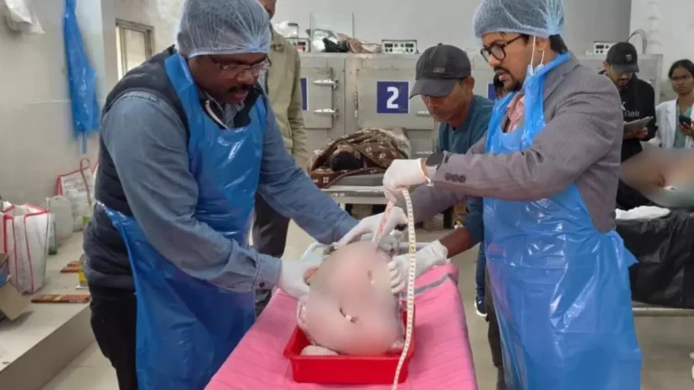 https://news4u36.in/giant-uterus-fibroid-found-during-postmortem-ambikapur-chhattisgarh/