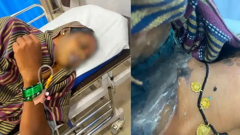 https://news4u36.in/bhilai-women-chemical-attack/